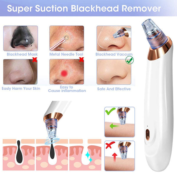 Blackhead Removal Skin Care Tool Face for Deep Pore Acne Pimple Vacuum Suction Facial Diamond Beauty Tool Dropshipping Discounte